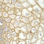 HLA-A Antibody in Immunohistochemistry (Paraffin) (IHC (P))