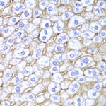 HLA-A Antibody in Immunohistochemistry (Paraffin) (IHC (P))