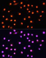 GCN5 Antibody in Immunocytochemistry (ICC/IF)