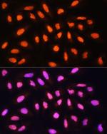 GCN5 Antibody in Immunocytochemistry (ICC/IF)