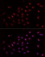 GCN5 Antibody in Immunocytochemistry (ICC/IF)