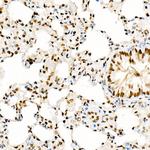 GCN5 Antibody in Immunohistochemistry (Paraffin) (IHC (P))