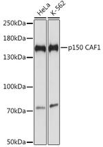 CAF1 p150 Antibody in Western Blot (WB)