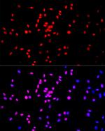 H3K27me1 Antibody in Immunocytochemistry (ICC/IF)