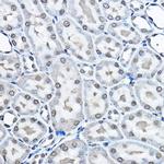 H3K27me1 Antibody in Immunohistochemistry (Paraffin) (IHC (P))