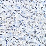 H3K27me1 Antibody in Immunohistochemistry (Paraffin) (IHC (P))