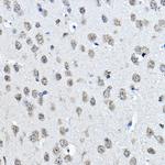 H3K27me1 Antibody in Immunohistochemistry (Paraffin) (IHC (P))