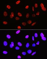 H3R2me2s Antibody in Immunocytochemistry (ICC/IF)