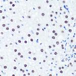 H3R2me2s Antibody in Immunohistochemistry (Paraffin) (IHC (P))