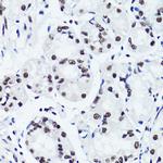 H3R2me2s Antibody in Immunohistochemistry (Paraffin) (IHC (P))