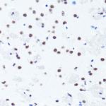 H3R2me2s Antibody in Immunohistochemistry (Paraffin) (IHC (P))