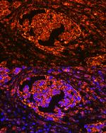 Tartrate Resistant Acid Phosphatase Antibody in Immunohistochemistry (Paraffin) (IHC (P))