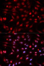 APE1 Antibody in Immunocytochemistry (ICC/IF)