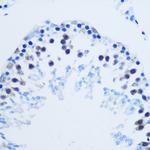 H3R8me2a Antibody in Immunohistochemistry (Paraffin) (IHC (P))