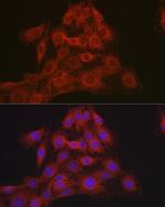 NR3C2 Antibody in Immunocytochemistry (ICC/IF)