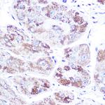 NR3C2 Antibody in Immunohistochemistry (Paraffin) (IHC (P))