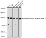 NR3C2 Antibody in Western Blot (WB)