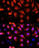 alpha Actinin 2 Antibody in Immunocytochemistry (ICC/IF)