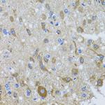 DYNC1I1 Antibody in Immunohistochemistry (Paraffin) (IHC (P))