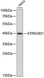 ATP6V0D1 Antibody in Western Blot (WB)