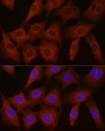 eIF4E2 Antibody in Immunocytochemistry (ICC/IF)