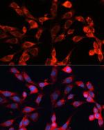 RT28 Antibody in Immunocytochemistry (ICC/IF)