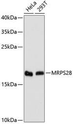 RT28 Antibody in Western Blot (WB)