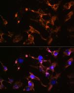 Amphiphysin Antibody in Immunocytochemistry (ICC/IF)