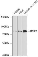 LIMK2 Antibody in Western Blot (WB)