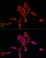 UBE2C Antibody in Immunocytochemistry (ICC/IF)