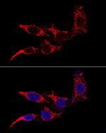 FIS1 Antibody in Immunocytochemistry (ICC/IF)