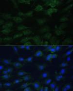 eIF1AX Antibody in Immunocytochemistry (ICC/IF)