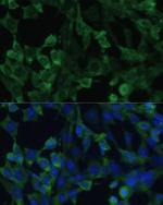 eIF1AX Antibody in Immunocytochemistry (ICC/IF)