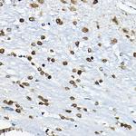 CIRBP Antibody in Immunohistochemistry (Paraffin) (IHC (P))