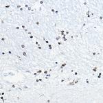 CIRBP Antibody in Immunohistochemistry (Paraffin) (IHC (P))