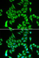 IREB2 Antibody in Immunocytochemistry (ICC/IF)