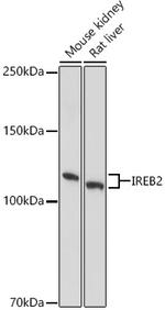 IREB2 Antibody in Western Blot (WB)