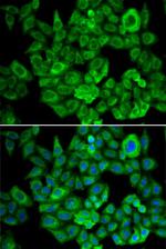 OGDH Antibody in Immunocytochemistry (ICC/IF)