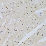 SNRPA Antibody in Immunohistochemistry (Paraffin) (IHC (P))