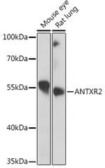 CMG2 Antibody in Western Blot (WB)