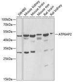 ATP6IP2 Antibody in Western Blot (WB)