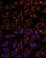 CCT3 Antibody in Immunocytochemistry (ICC/IF)