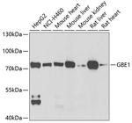 GBE1 Antibody in Western Blot (WB)