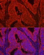 Galectin 2 Antibody in Immunohistochemistry (Paraffin) (IHC (P))