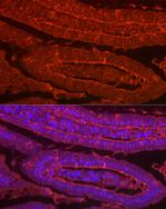 Galectin 2 Antibody in Immunohistochemistry (Paraffin) (IHC (P))