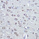 NFS1 Antibody in Immunohistochemistry (Paraffin) (IHC (P))