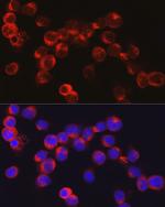 DEFA1 Antibody in Immunocytochemistry (ICC/IF)