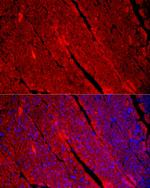 Myosin heavy chain 1 Antibody in Immunocytochemistry (ICC/IF)