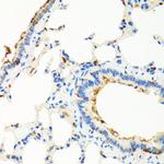 RGS5 Antibody in Immunohistochemistry (Paraffin) (IHC (P))