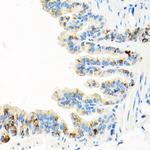 RGS5 Antibody in Immunohistochemistry (Paraffin) (IHC (P))